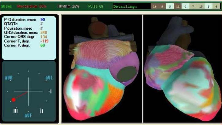 Coloured diagram of a heart showing the pulse and rhythm