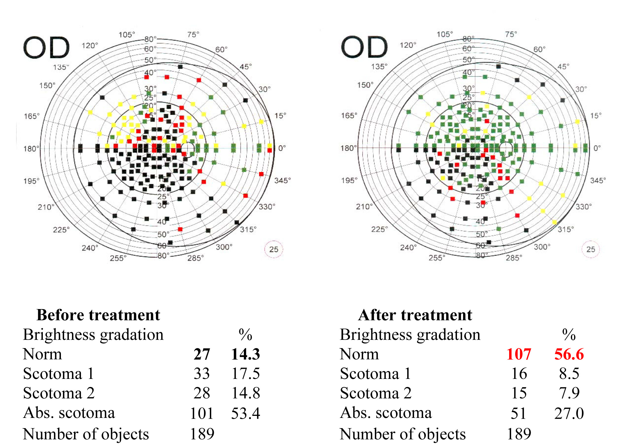 Field of vision test