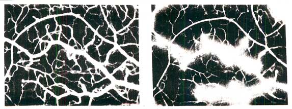 Before and after photos: Superoxide