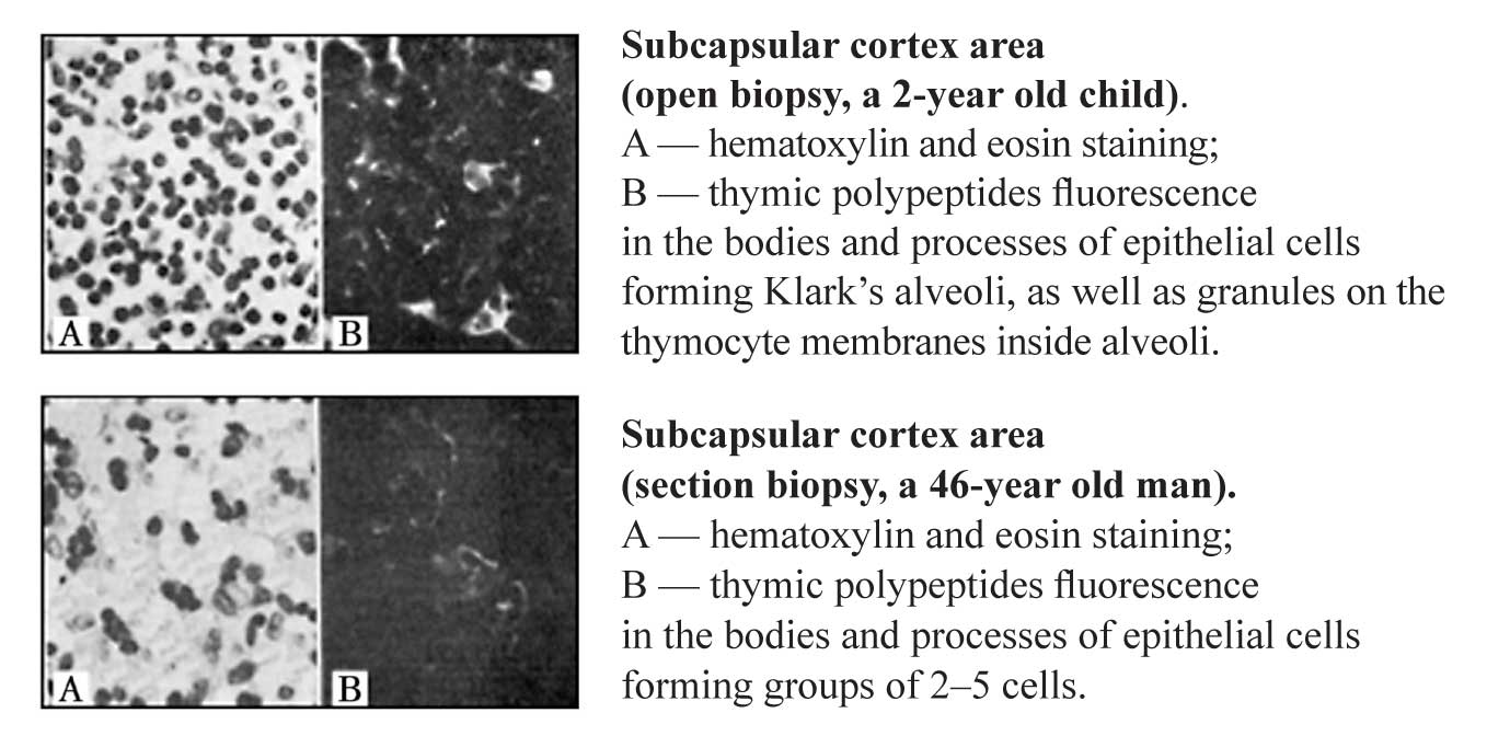 Age-related involution of thymus