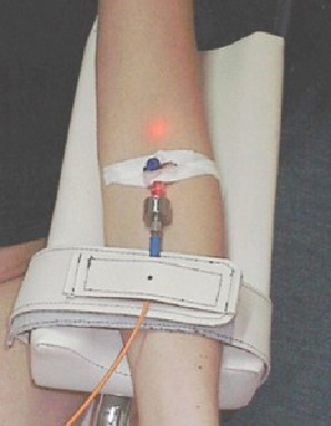 Figure 1: Intravenous blood illumination method
