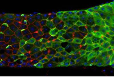 Cells and stem cells in fruit fly intestine.