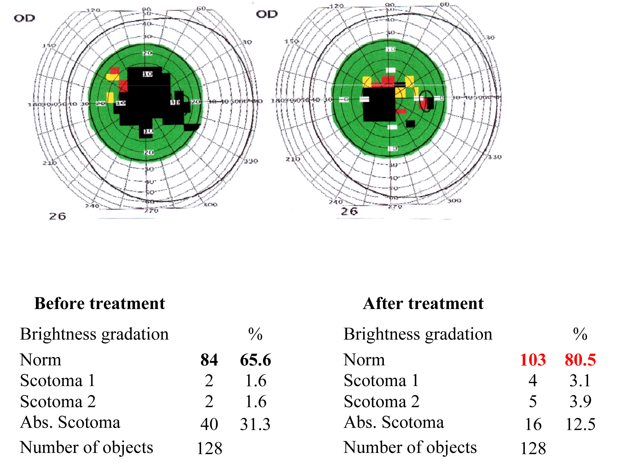 Results of the visual functions tests before and after the treatment course 7